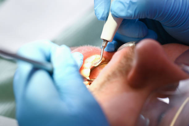 Best Tooth Infection Emergency Dentist  in North Alamo, TX